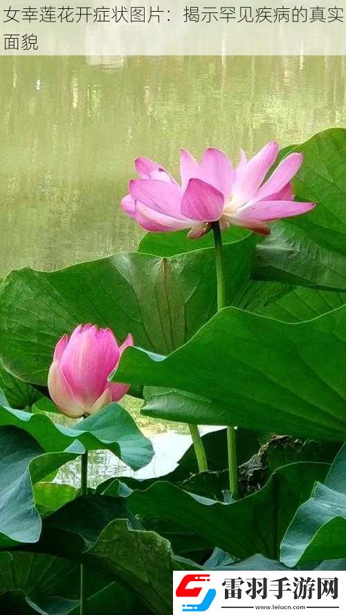女幸蓮花開癥狀圖片