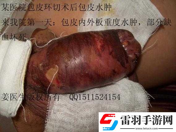 男人割皮包后為何要手舉著樣子